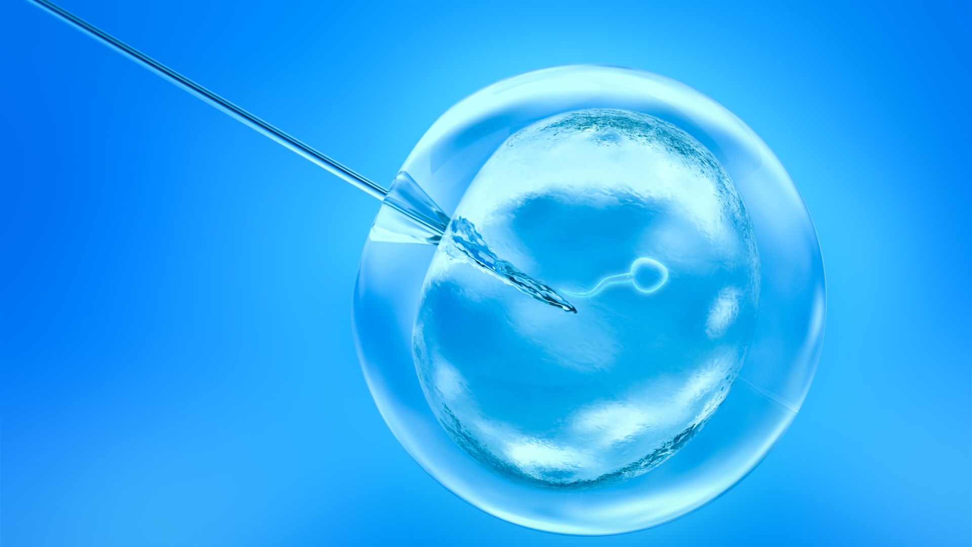 IVF with Asherman's Syndrome